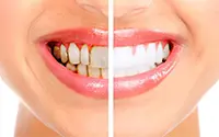 Rehabilitación oral